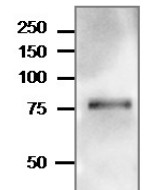 TGG1 | Myrosinase 1 ( BGL38) in the group Antibodies Plant/Algal / Hormones / Brassinosteroids/regulation at Agrisera AB (Antibodies for research) (AS20 4416)
